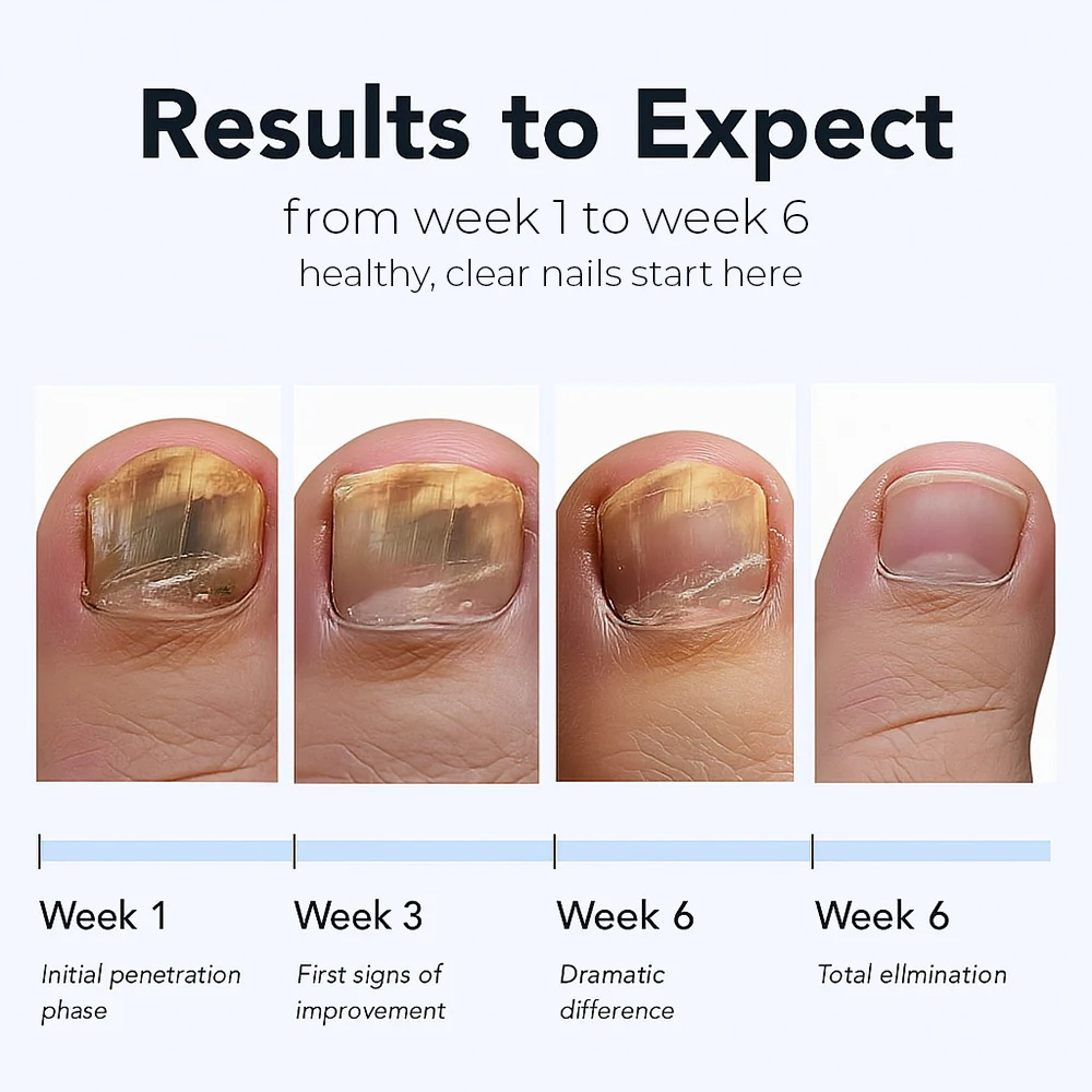 Naturex® Fungal Nail Renewal Patches