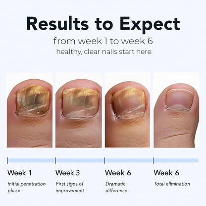 Naturex® Fungal Nail Renewal Patches
